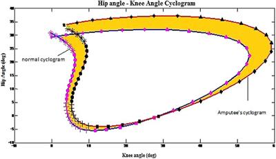 Analysis of Interrelationships among Voluntary and Prosthetic Leg Joint Parameters Using Cyclograms